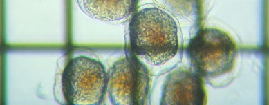 fig.07 �P���~�W���R���i���j