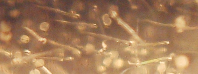 fig.b10 ����P�O����