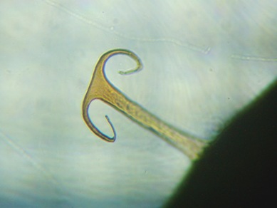 fig.03 ���̂ЂƂ�