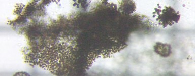 fig.04 �~�N���L�X�e�B�X