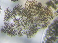 fig.06 �~�N���L�X�e�B�X