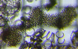 fig.04 �~�N���L�X�e�B�X