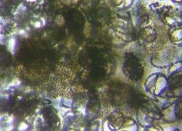 fig.07 �~�N���L�X�e�B�X