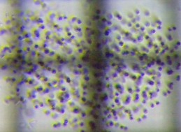 fig.11 �N���I�R�b�N�X��