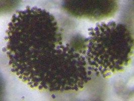 fig.05 �~�N���L�X�e�B�X