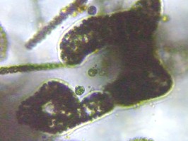 fig.06 �~�N���L�X�e�B�X