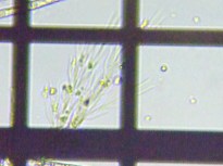 fig.11 �T���c�i�M��