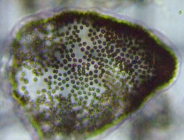 fig.05 �~�N���L�X�e�B�X