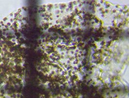 fig.06 �~�N���L�X�e�B�X