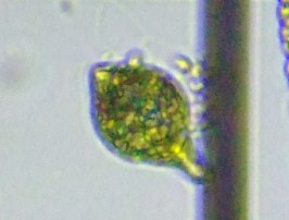 fig.17 ���[�O���i��