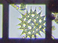 fig.16 �N���V���E���i�Α��j