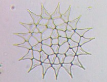 fig.11 �N���V���E���i�Α��j