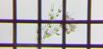 fig.14 �T���c�i�M���i���������j