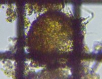 fig.11 �f�B�t���M�A��