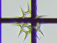 fig.13 �N���V���E���i�Α��j