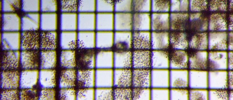 fig.04 �~�N���L�X�e�B�X