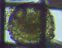 fig.11 �f�B�t���M�A��