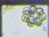 fig.11 �^�}�q�Q�}����