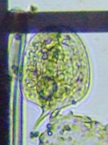 fig.14 �t�@�[�N�X��