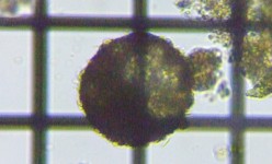 fig.12 �f�B�t���M�A��