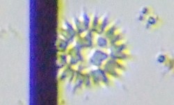 fig.14 �N���V���E���i�Α��j