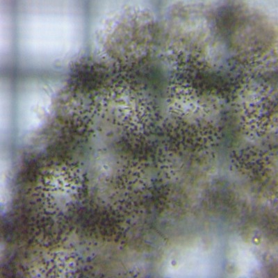 fig.02 �~�N���L�X�e�B�X