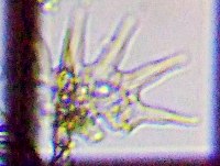 fig.14 �z�\�A�V�A���[�o