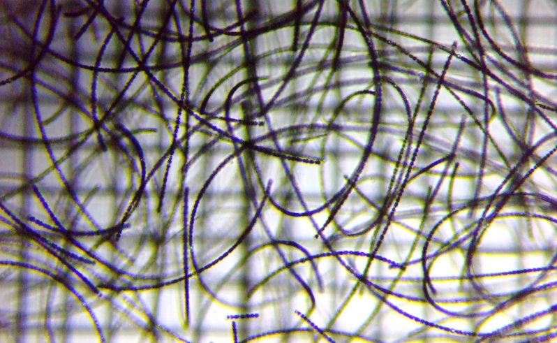 fig.01 �A�i�x�i