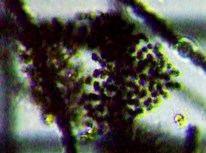 fig.03 �~�N���L�X�e�B�X