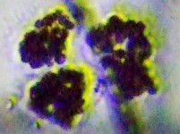 fig.05 �~�N���L�X�e�B�X