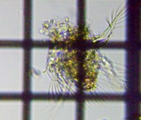 fig.03 �~�W���R�����V
Hexarthra mira