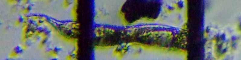 fig.10 ���[�O���i��