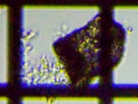 fig.11 �f�B�t���M�A��