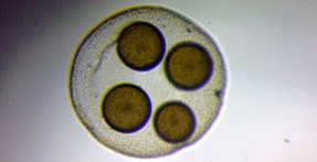 fig.11 �{���{�b�N�X��