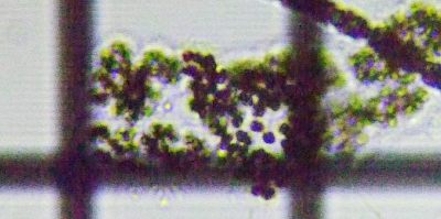 fig.07 �~�N���L�X�e�B�X