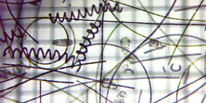 fig.00a �����̗l�q�i�{�[�g�V���j