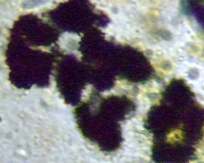 fig.04 �~�N���L�X�e�B�X