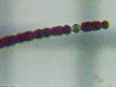 fig.01 �A�i�x�i�}�N���X�|�[�� Anabaena macrospora