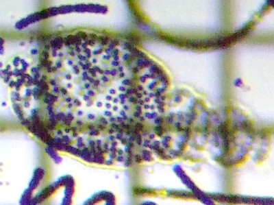 fig.03 �~�N���L�X�e�B�X�x�[�[���x���M�[ Microcystis Wesenbergii