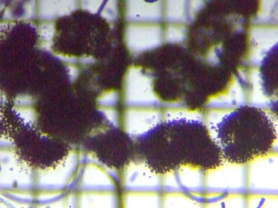 fig.04 �~�N���L�X�e�B�X�G���M�m�[�U Microcystis Aeruginosa