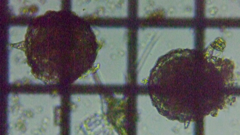 fig.01 �g�Q�c�{�J���� Difflugia corona