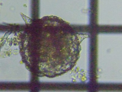 fig.02 �g�Q�c�{�J���� Difflugia corona