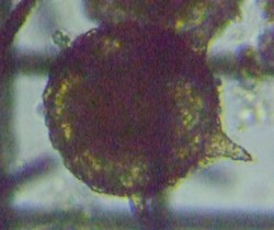 fig.04 �g�Q�c�{�J���� Difflugia corona