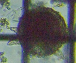 fig.05 �g�Q�c�{�J���� Difflugia corona