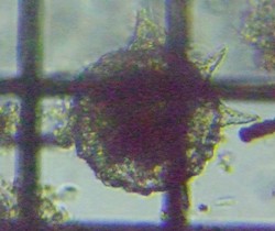 fig.06 �g�Q�c�{�J���� Difflugia corona