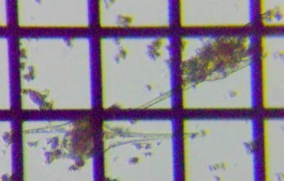 fig.11 �c�m�I�r���V