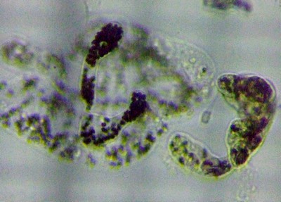 fig.01 �~�N���L�X�e�B�X�x�[�[���x���M�[ Microcystis Wesenbergii