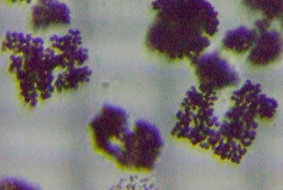 fig.04 �~�N���L�X�e�B�X�r���f�B�X Microcystis Aeruginosa