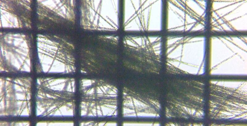 fig.01 �A�t�@�j�]���m���� Aphanizomenon sp.