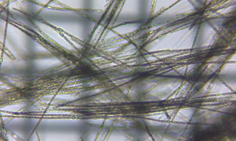 fig.01 �A�t�@�j�]���m���� Aphanizomenon sp.